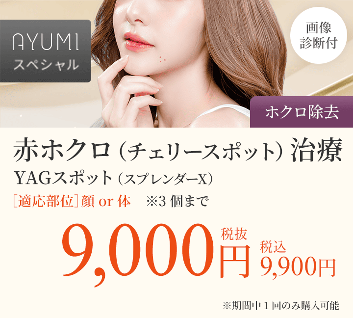 AYUMIスペシャル赤ホクロ（チェリースポット）治療　YAGスポット（スプレンダーX）・画像診断付き（ホクロ除去）