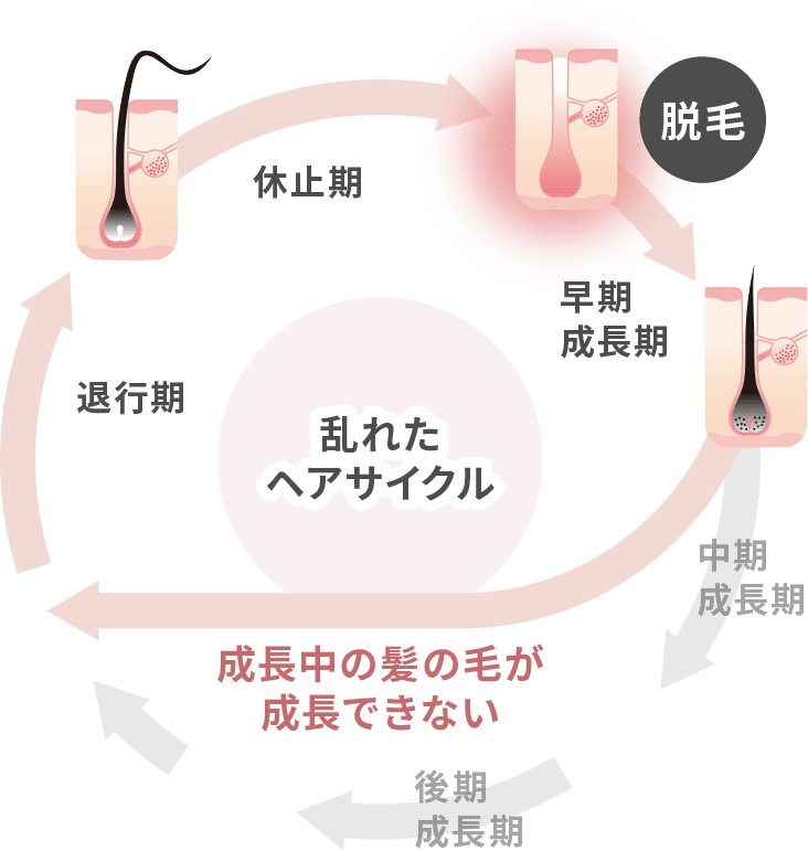 乱れたヘアサイクル