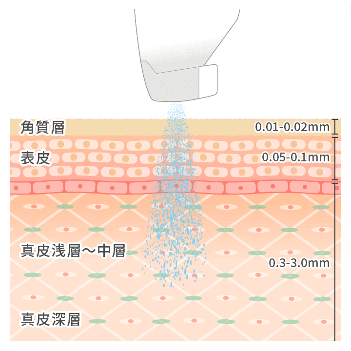 超微細な氷の結晶（アイスニードル）となった薬剤を、高圧CO₂ガスで一気に噴射