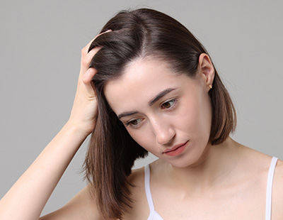 女性の育毛・薄毛治療