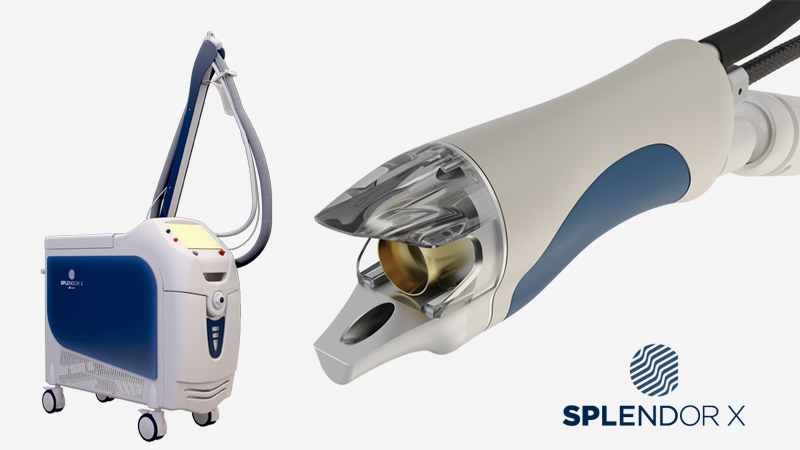 【徹底比較】スプレンダーXとジェントルマックスプロ、あなたに最適な医療脱毛レーザーは？